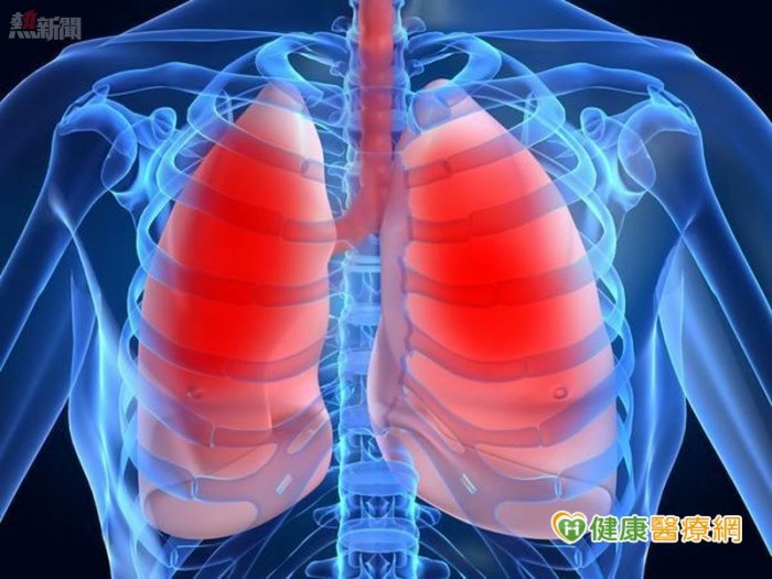 每年一次胸部Ｘ光　可有效發現早期肺癌？