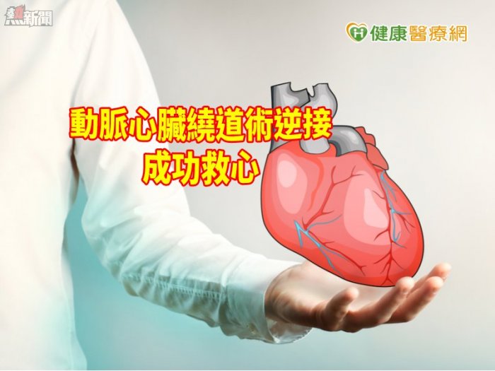 心血管嚴重阻塞　心臟繞道「逆接」術成功救心